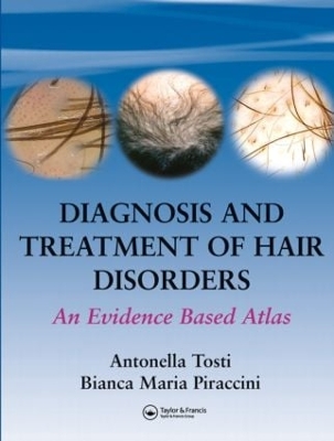 Diagnosis and Treatment of Hair Disorders by Antonella Tosti