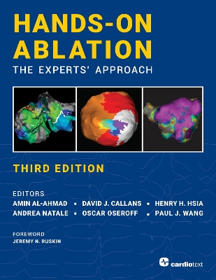 Hands-On Ablation: The Experts' Approach, Third Edition: The Experts' Approach book