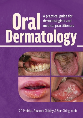 Oral Dermatology: A practical guide for dermatologists and medical practitioners book