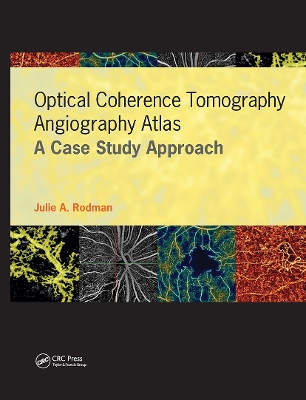 Optical Coherence Tomography Angiography Atlas: A Case Study Approach book
