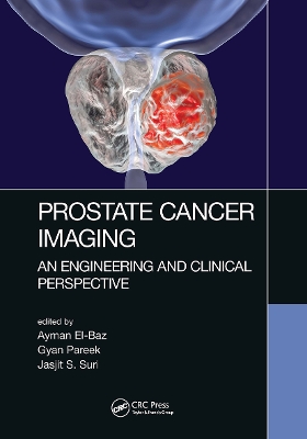 Prostate Cancer Imaging: An Engineering and Clinical Perspective by Ayman El-Baz