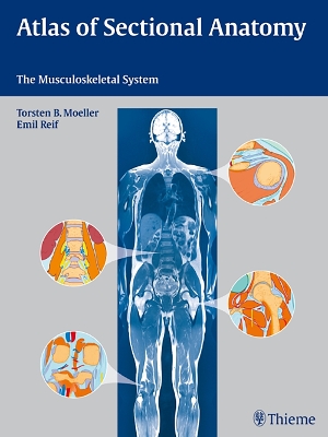 Atlas of Sectional Anatomy: The Musculoskeletal System book