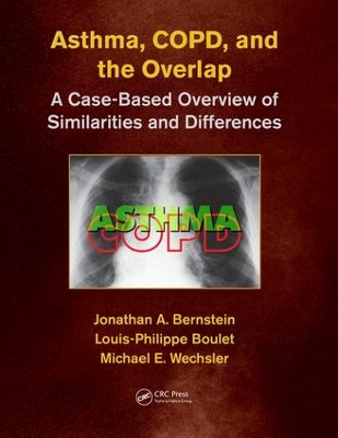 Asthma, COPD, and Overlap by Jonathan A. Bernstein