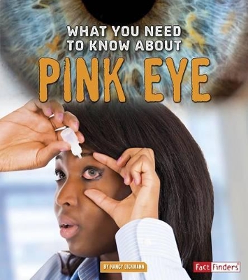 What You Need to Know about Pink Eye book