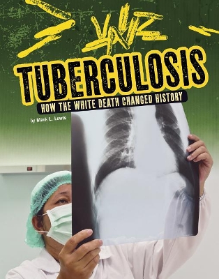 Tuberculosis book