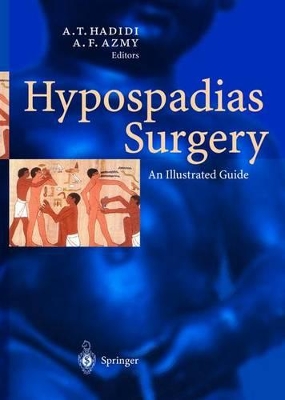 Hypospadias Surgery book