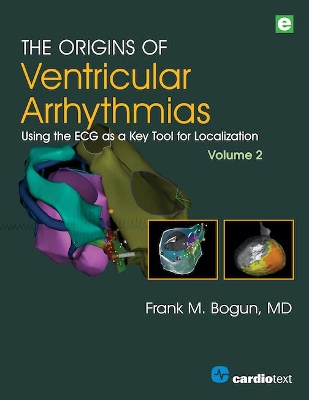 The Origins of Ventricular Arrhythmias, Volume 2: Using the ECG as a Key Tool for Localization, Volume 2 book