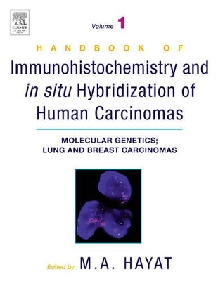 Handbook of Immunohistochemistry and in Situ Hybridization of Human Carcinomas by M. A. Hayat