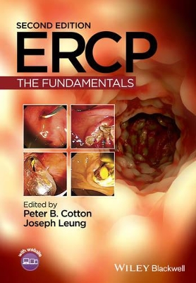 Ercp - the Fundamentals 2E book