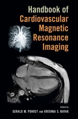 Handbook of Cardiovascular Magnetic Resonance Imaging book