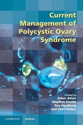 Current Management of Polycystic Ovary Syndrome book