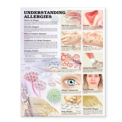 Understanding Allergies Anatomical Chart by Anatomical Chart Company