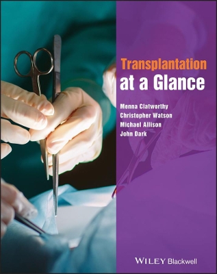 Transplantation at a Glance book