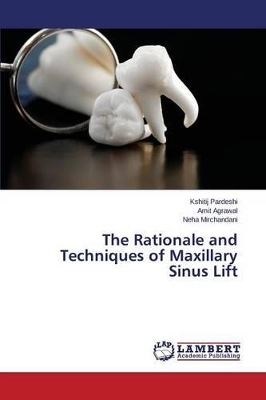 The Rationale and Techniques of Maxillary Sinus Lift book