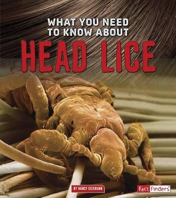 What You Need to Know about Head Lice book