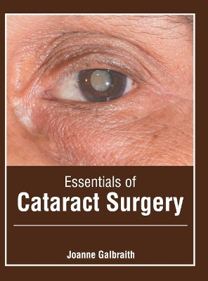 Essentials of Cataract Surgery book