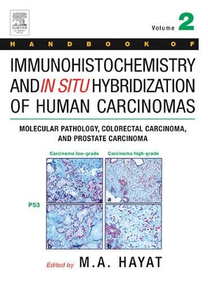 Handbook of Immunohistochemistry and in Situ Hybridization of Human Carcinomas book