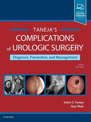 Complications of Urologic Surgery book