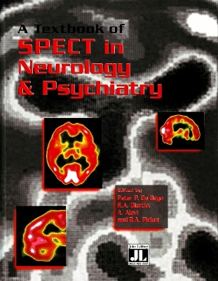 Textbook of SPECT book