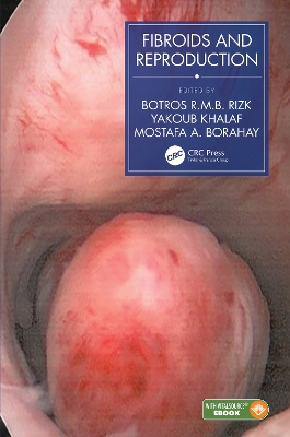 Fibroids and Reproduction book