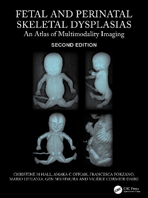 Fetal and Perinatal Skeletal Dysplasias: An Atlas of Multimodality Imaging by Christine M Hall