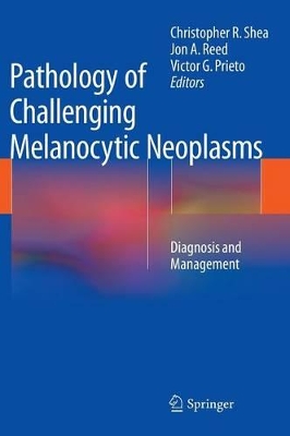 Pathology of Challenging Melanocytic Neoplasms book