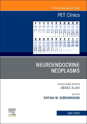 Neuroendocrine Neoplasms, An Issue of PET Clinics: Volume 18-2 book