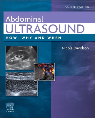 Abdominal Ultrasound: How, Why and When book