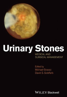 Urinary Stones book