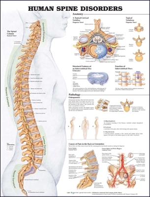 Human Spine Disorders Anatomical Chart by Anatomical Chart Company