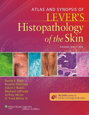 Atlas and Synopsis of Lever's Histopathology of the Skin book