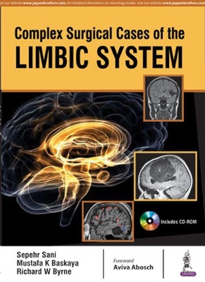 Complex Surgical Cases of the Limbic System book