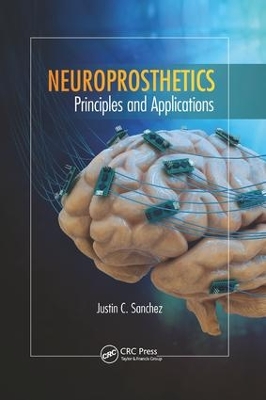 Neuroprosthetics book