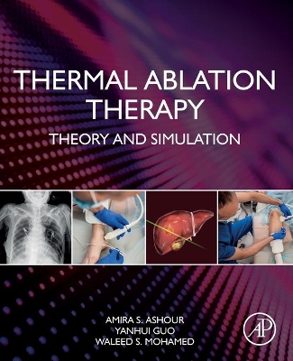 Thermal Ablation Therapy: Theory and Simulation book