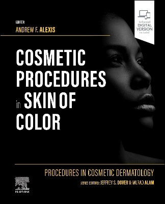 Procedures in Cosmetic Dermatology: Cosmetic Procedures in Skin of Color book