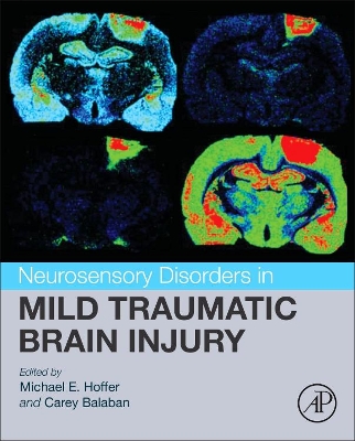 Neurosensory Disorders in Mild Traumatic Brain Injury book
