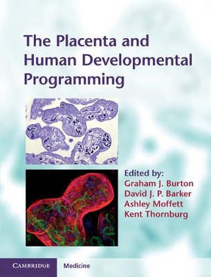 Placenta and Human Developmental Programming book