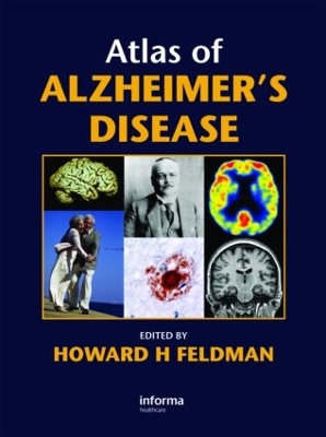 Atlas of Alzheimer's Disease by Howard Feldman