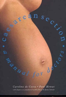 Caesarean Section: A Manual for Doctors book