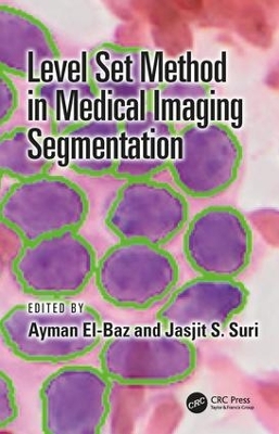 Level Set Method in Medical Imaging Segmentation book