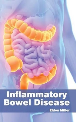 Inflammatory Bowel Disease book