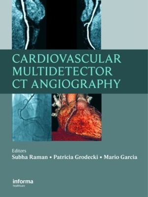 Cardiovascular Multidetector CT Angiography book