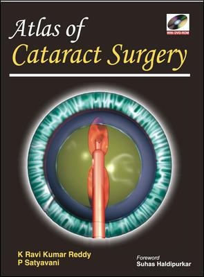 Atlas of Cataract Surgery book