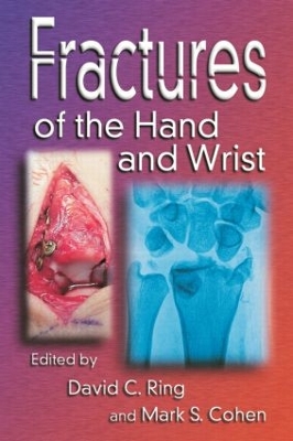 Fractures of the Hand and Wrist book