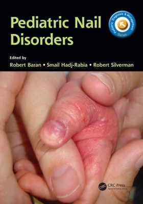 Pediatric Nail Disorders book