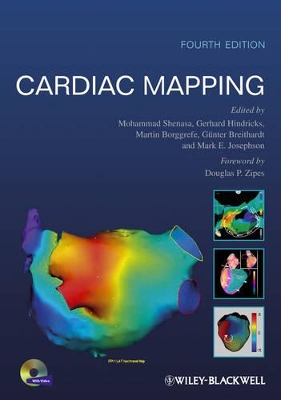 Cardiac Mapping book