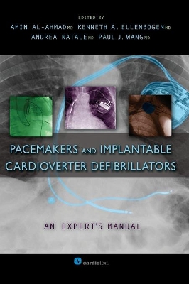 Pacemakers and Implantable Cardioverter Defibrillators book