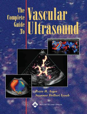 Complete Guide to Vascular Ultrasound book