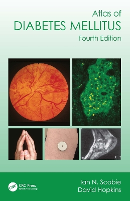 Atlas of Diabetes Mellitus book