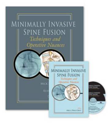Minimally Invasive Spine Fusion: Techniques and Operative Nuances Book by Mick Perez-Cruet